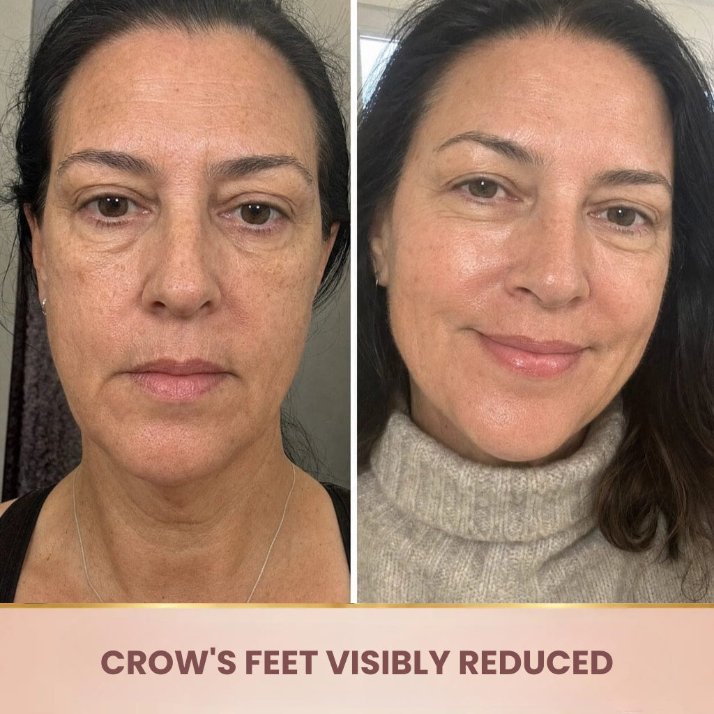 Lorovia – Korean Serum, Lifting Effect From First Application