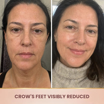Lorovia – Korean Serum, Lifting Effect From First Application