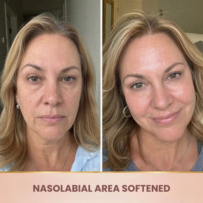 Lorovia – Korean Serum, Lifting Effect From First Application