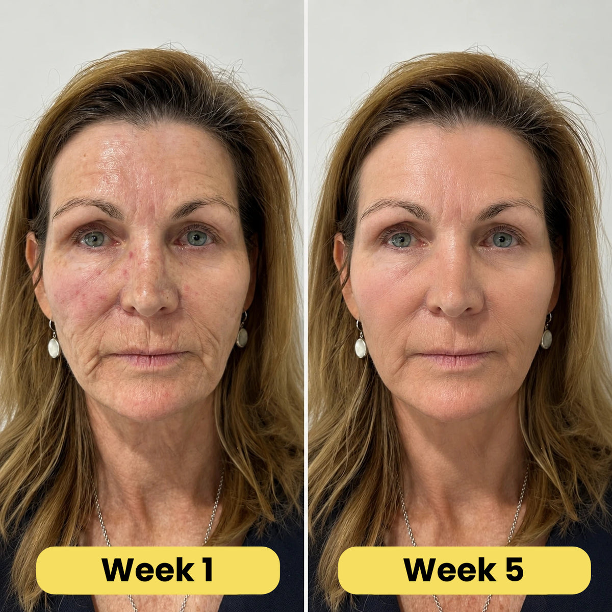 VoluFine | Korean Collagen Serum for Mature Skin