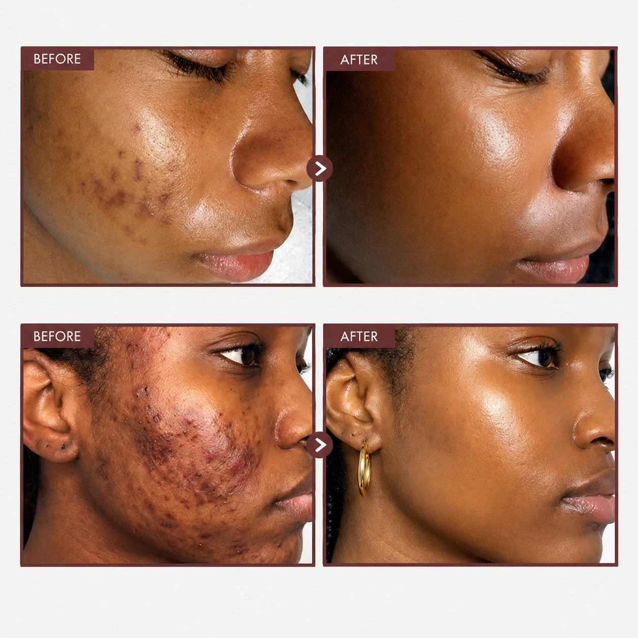 LOROVIA™ Korean Advanced Arbutin Brightening Cream